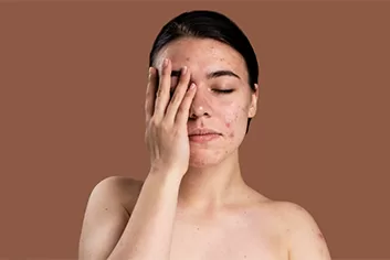 Acne & Skincare